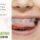 orthodontic care