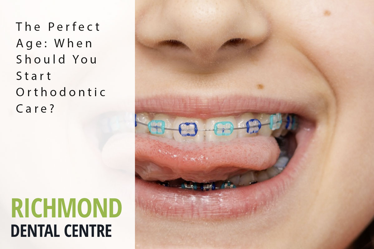 The Perfect Age When Should You Start Orthodontic Care? Richmond