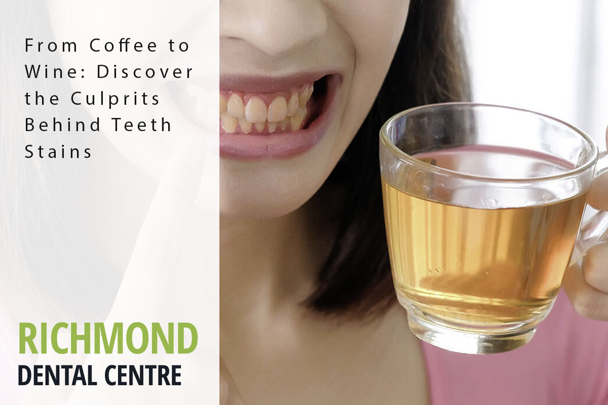 richmond-blog-staining teeth staining