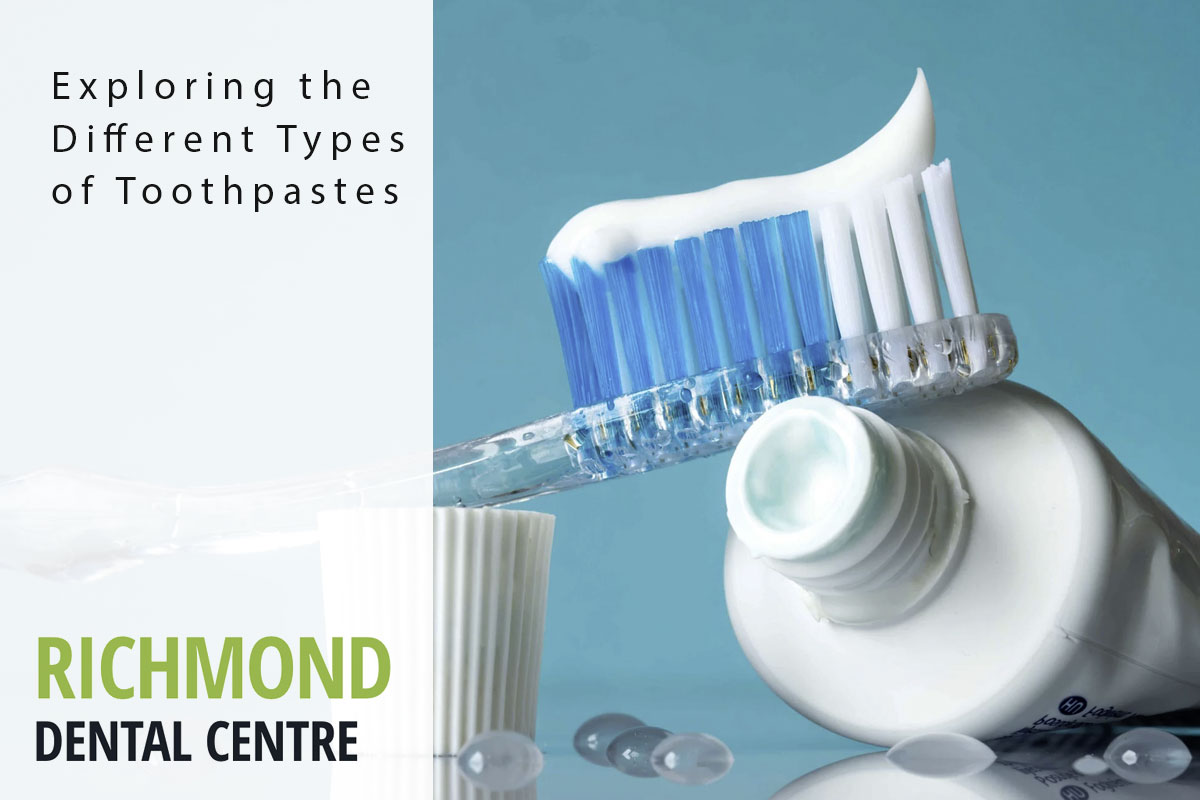 Exploring the Different Types of Toothpastes - Richmond Dental Centre