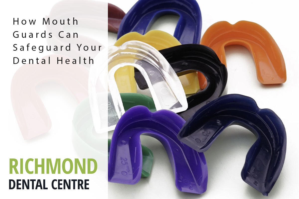 richmond-blog-mouthguard mouthguard