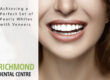veneers