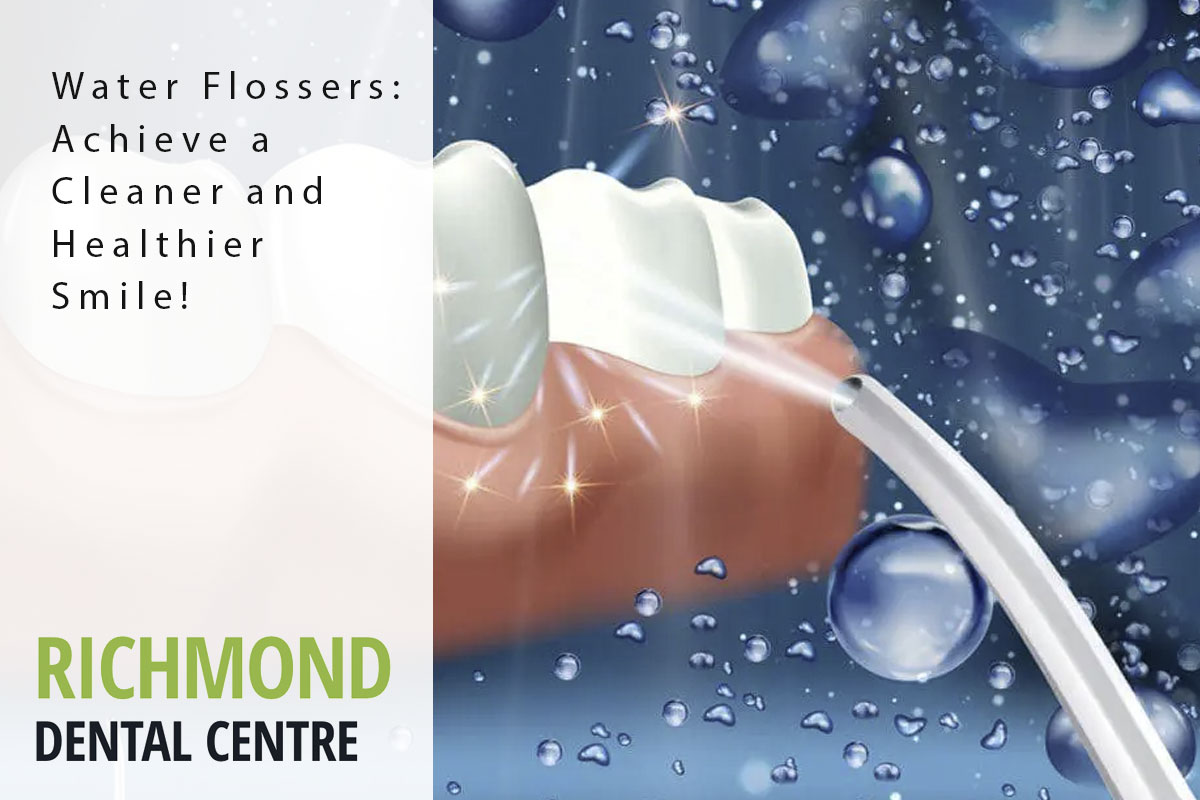 richmond-blog-waterflosser